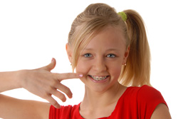 photo of young girls with braces